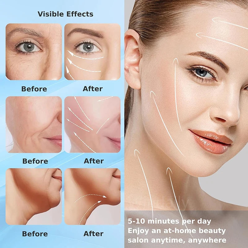 Anti winkle facial massager - westo voga